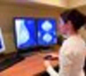 El Servicio Extremeño de Salud adjudica un contrato de diagnóstico 