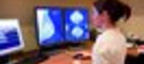 El Servicio Extremeño de Salud adjudica un contrato de diagnóstico 