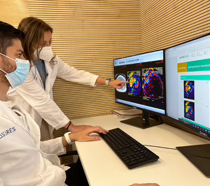 Ascires desarrolla HepaTools, una herramienta para realizar biopsias virtuales de hígado