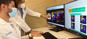 Ascires desarrolla HepaTools, una herramienta para realizar biopsias virtuales de hígado